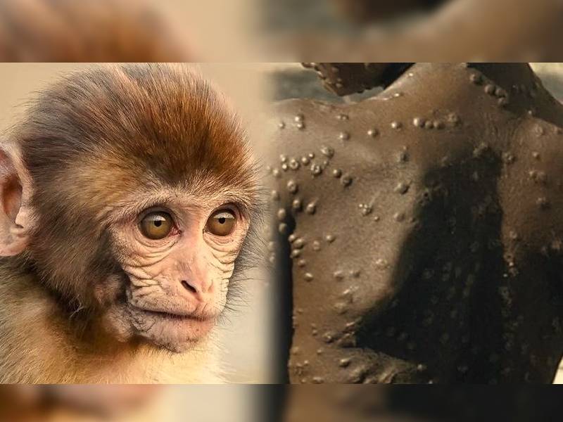 ¿Cómo se expandió la viruela del mono de África al resto del mundo?