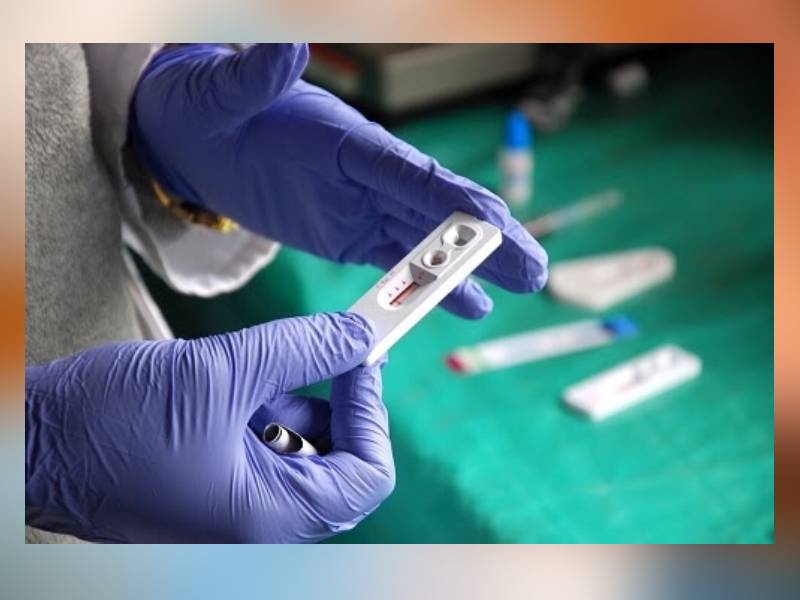 Fundación aplica pruebas rápidas de VIH de manera gratuita