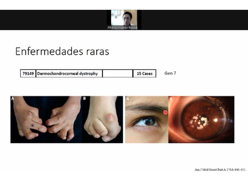 Enfermedades raras