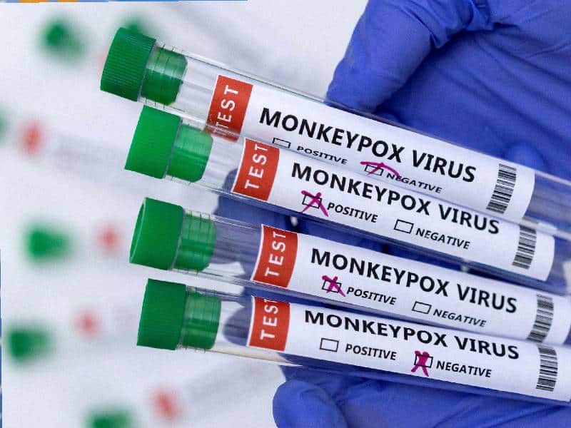 OMS declara la "Viruela del mono" como emergencia de salud internacional