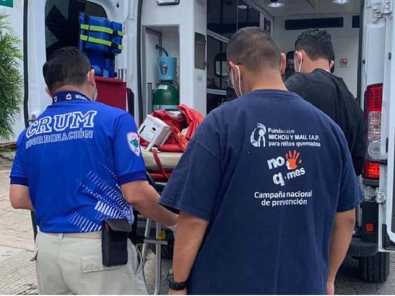 menor con quemaduras