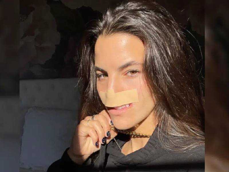 Modelo pierde su labio superior luego de ser atacada por un Pitbull