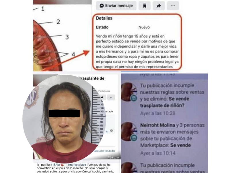 Ofrece riñón en venta