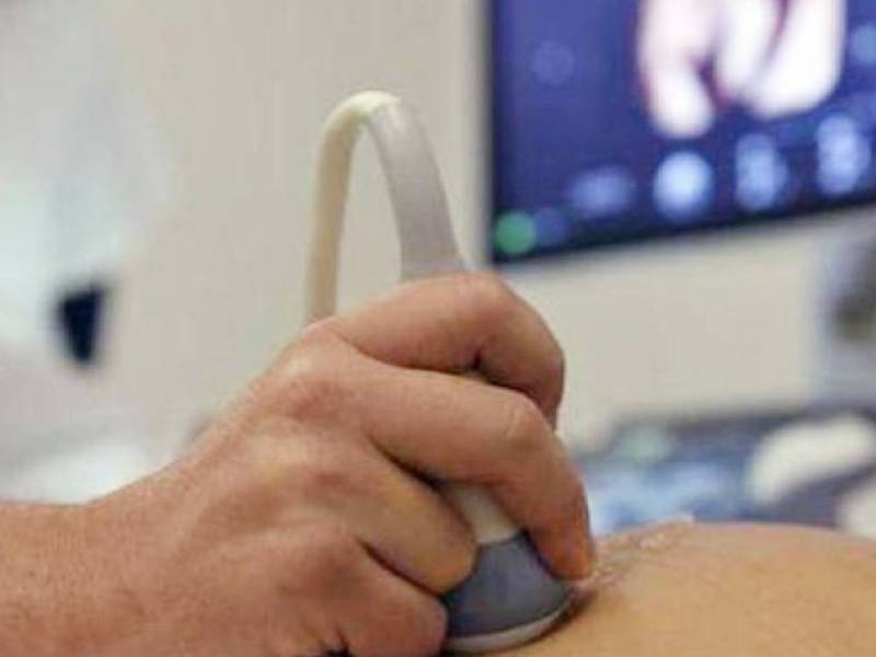 dereha aborto