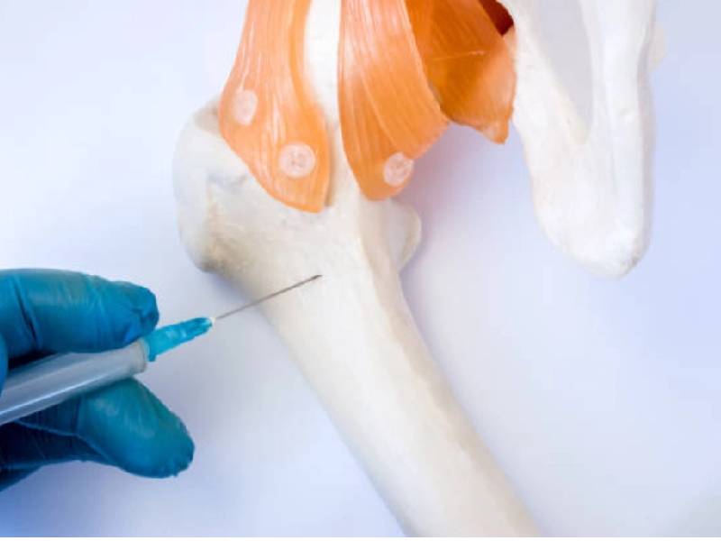 Terapias innovadoras contra el mieloma para más tiempo de vida
