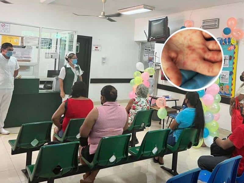 En Yucatán se registran al momento 59 casos de virus símica