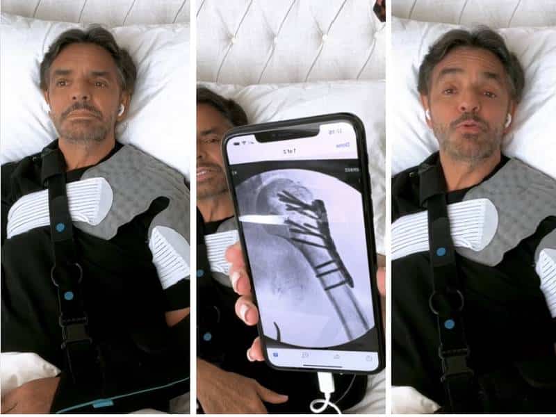 Tuve un accidente estúpido: Eugenio Derbez