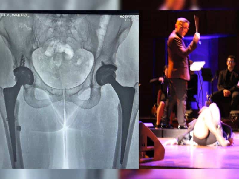 Alejandra Guzmán muestra radiografías tras dislocarse la cadera