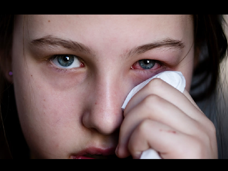 Cada 19 minutos se contagia una persona de conjuntivitis
