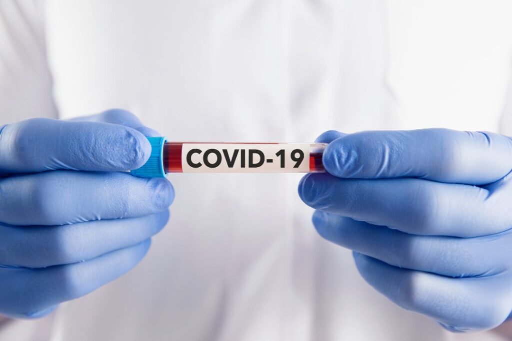 Yucatán reporta 78 casos acumulados de COVID-19 en 2025