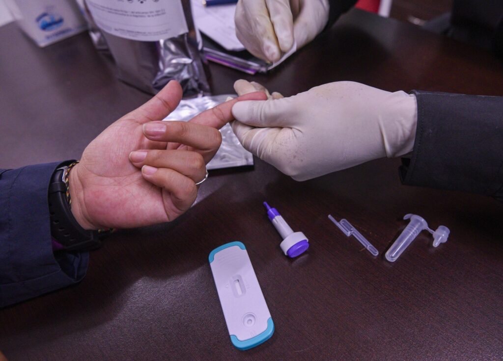 Autopruebas de VIH buscan ampliar diagnóstico temprano en Yucatán