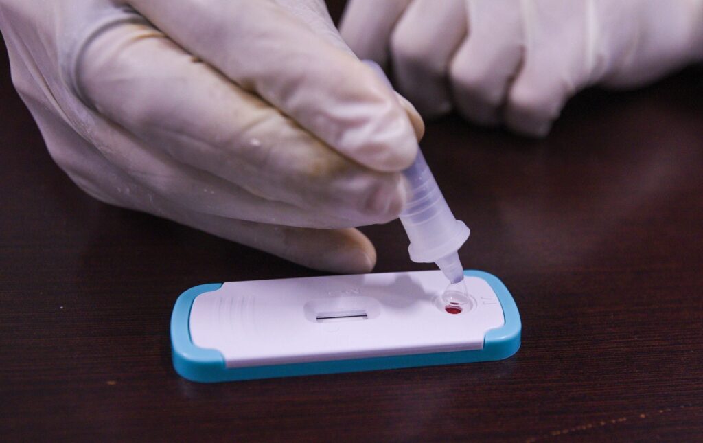 Hasta 15 años de cárcel por tener VIH: La ley que Morena quiere borrar en Yucatán